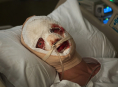 Clayface fremst&aring;r som en vaske&aelig;gte body horror-film i f&oslash;rste trailer