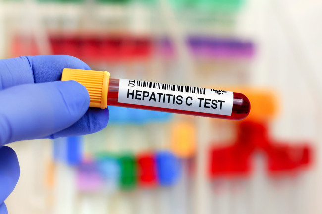 England på vej til at blive et af de første lande til at udrydde hepatitis C