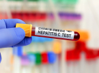 England p&aring; vej til at blive et af de f&oslash;rste lande til at udrydde hepatitis C
